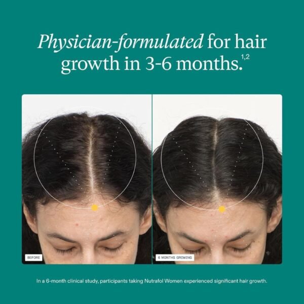 Nutrafol Women’s Hair Growth Supplements