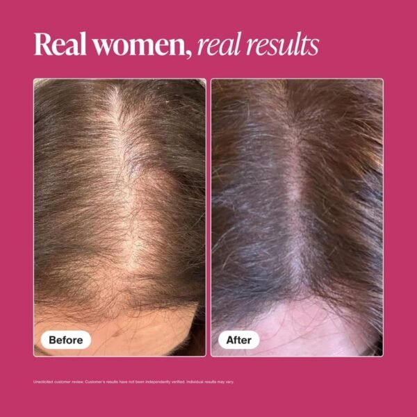 Viviscal Hair Growth Supplements